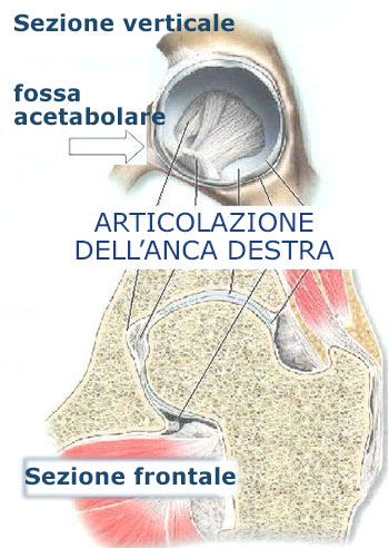 coxalgia