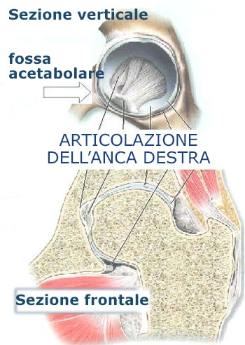 coxalgia coxalgia